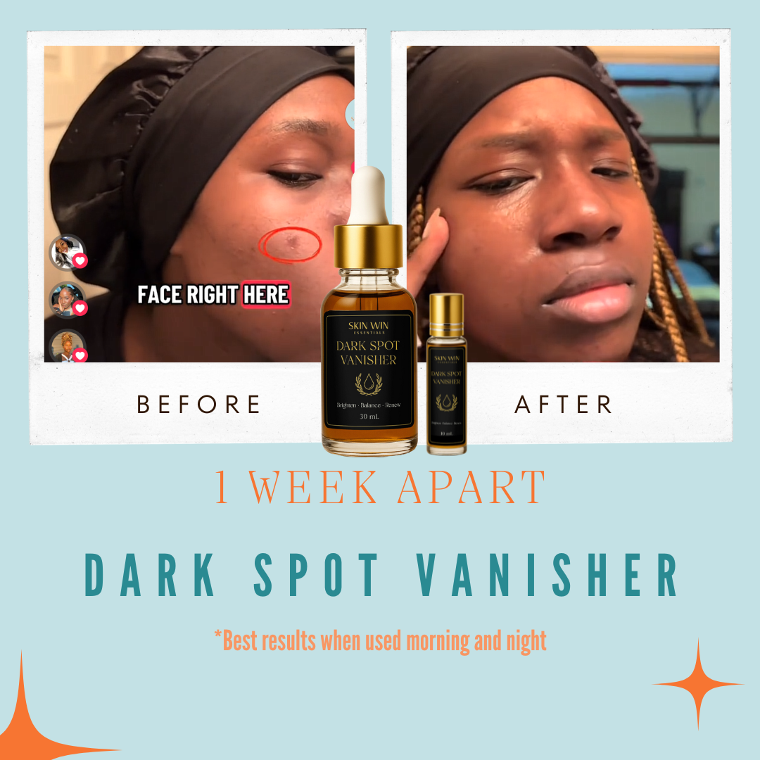 Dark Spot Vanisher - Brightening Oil