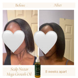 Scalp Nectar Mega Growth Oil