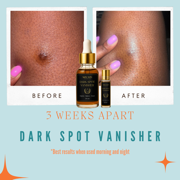 Dark Spot Vanisher - Botanical Brightening Elixir