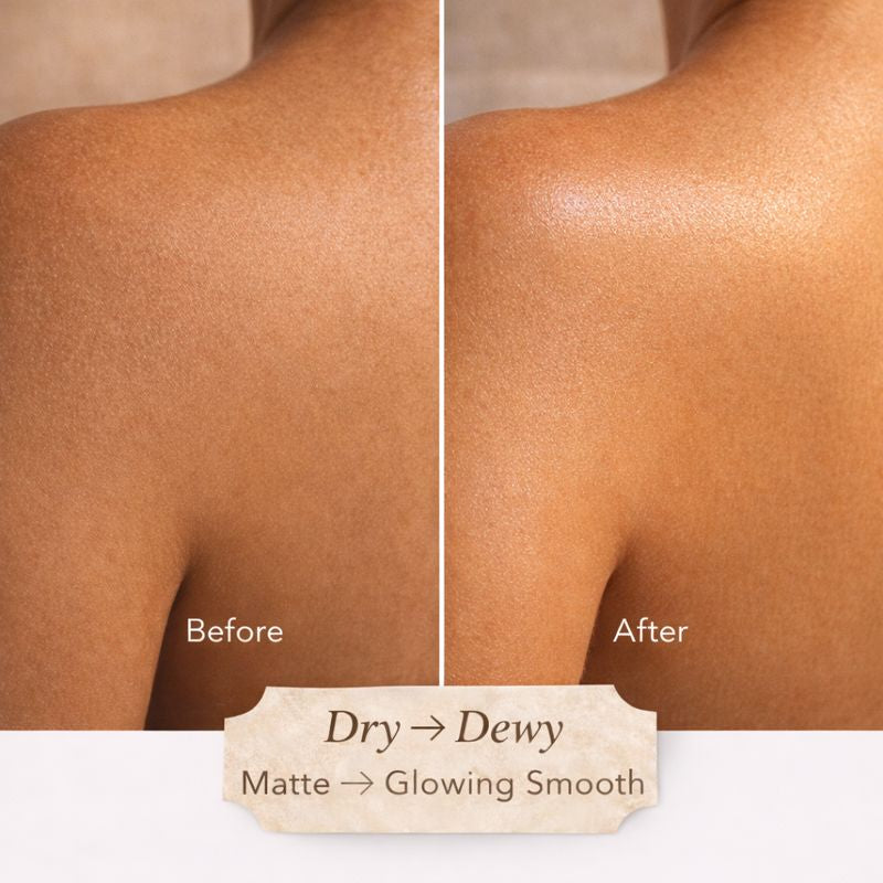 The Soft Skin System