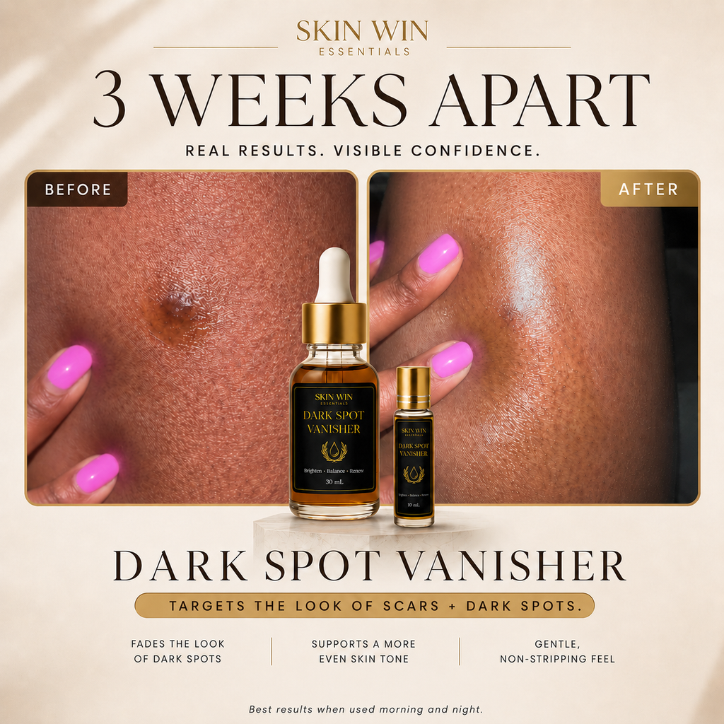 Dark Spot Vanisher - Brightening Oil
